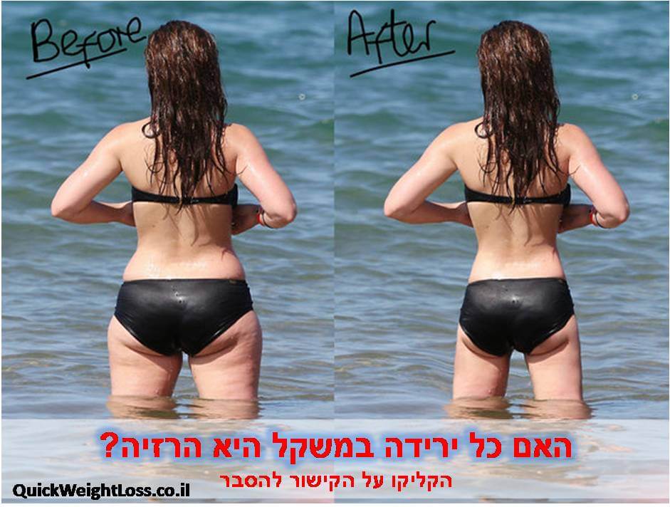 ירידה במשקל והרזיה